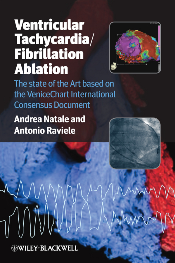 Ventricular Tachycardia / Fibrillation Ablation. The state of the Art based on the VeniceChart International Consensus Document