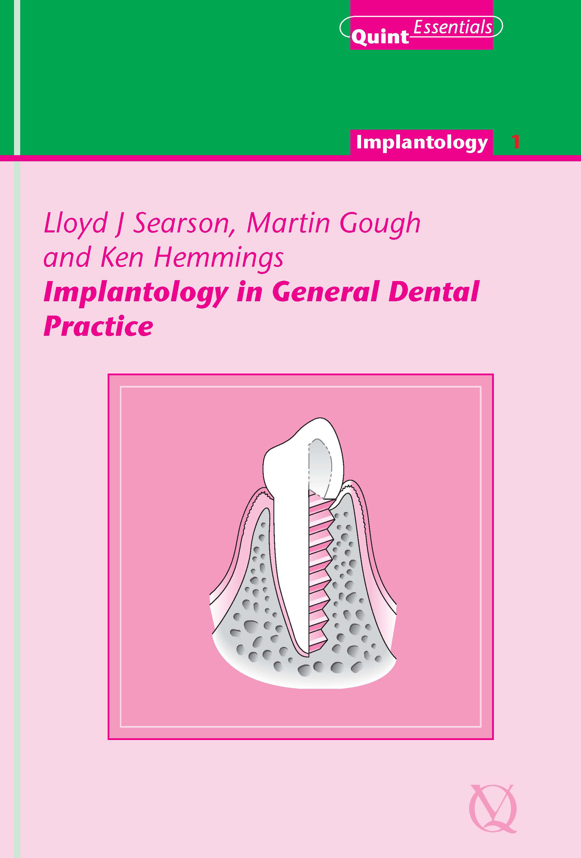 Implantology in General Dental Practice