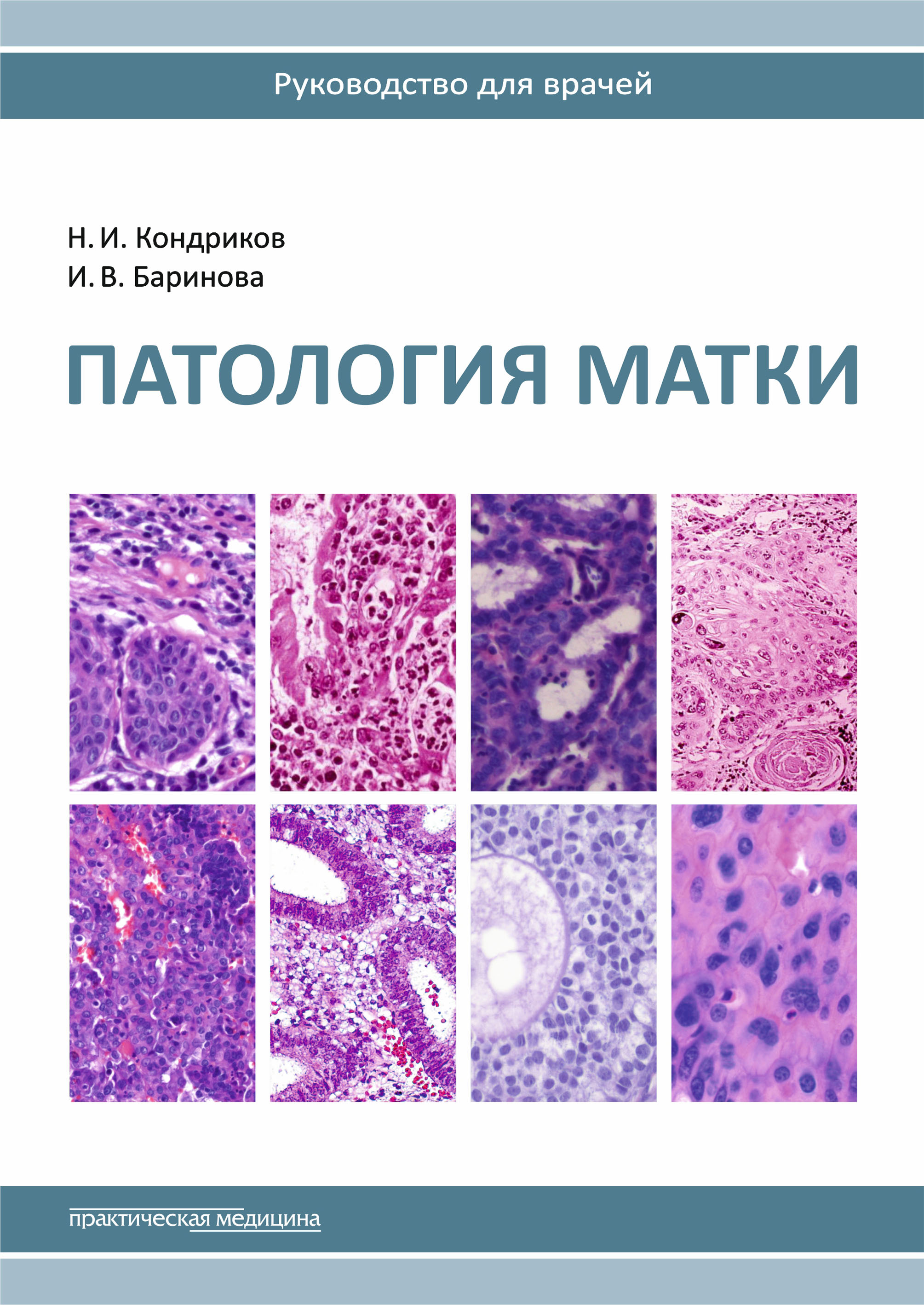 

Патология матки. Руководство для врачей