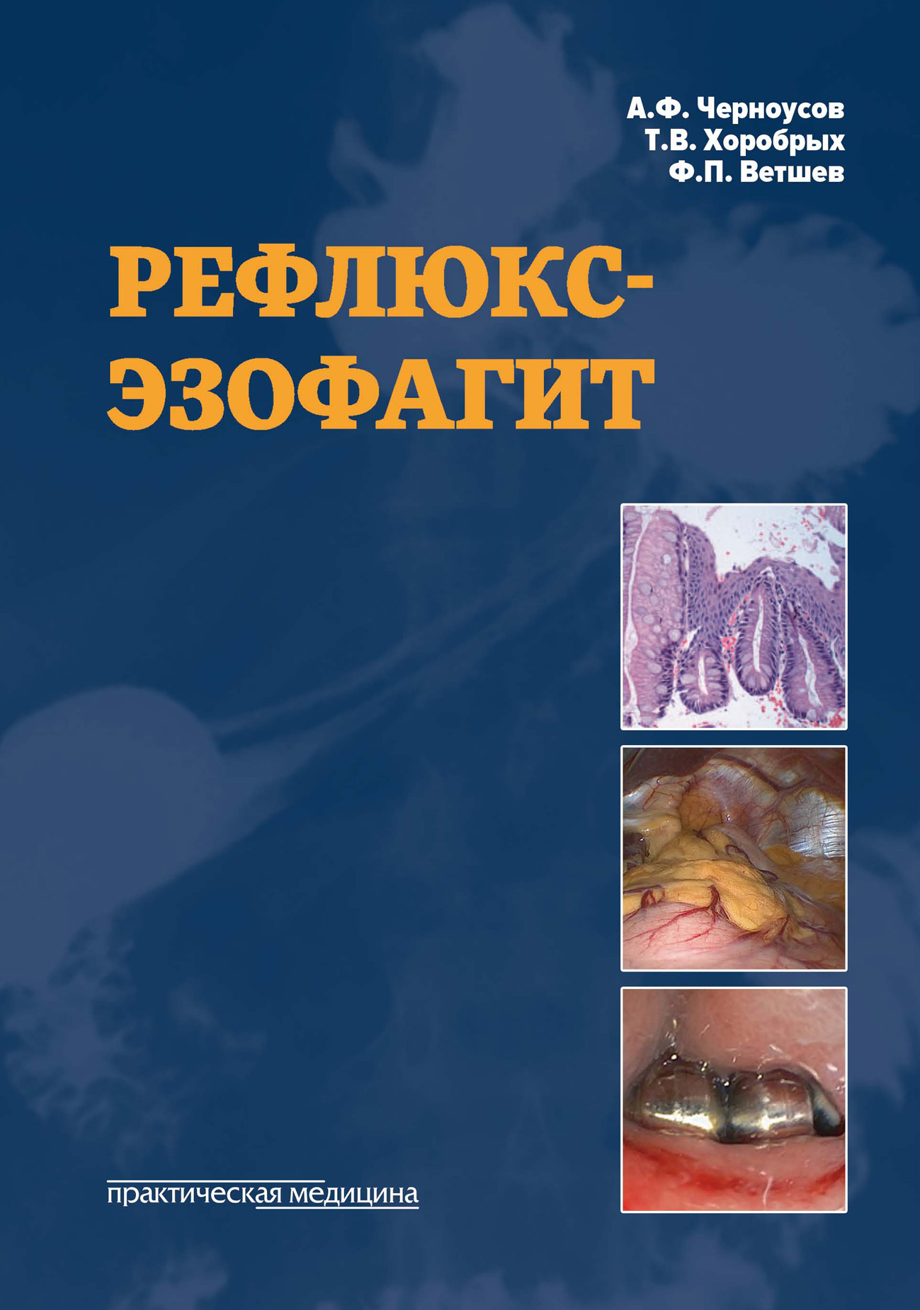 Гастроэзофагиальная рефлюксная болезнь (ГЭРБ) — симптомы, диагностика, лечение в НКЦ№2 (ЦКБ РАН)