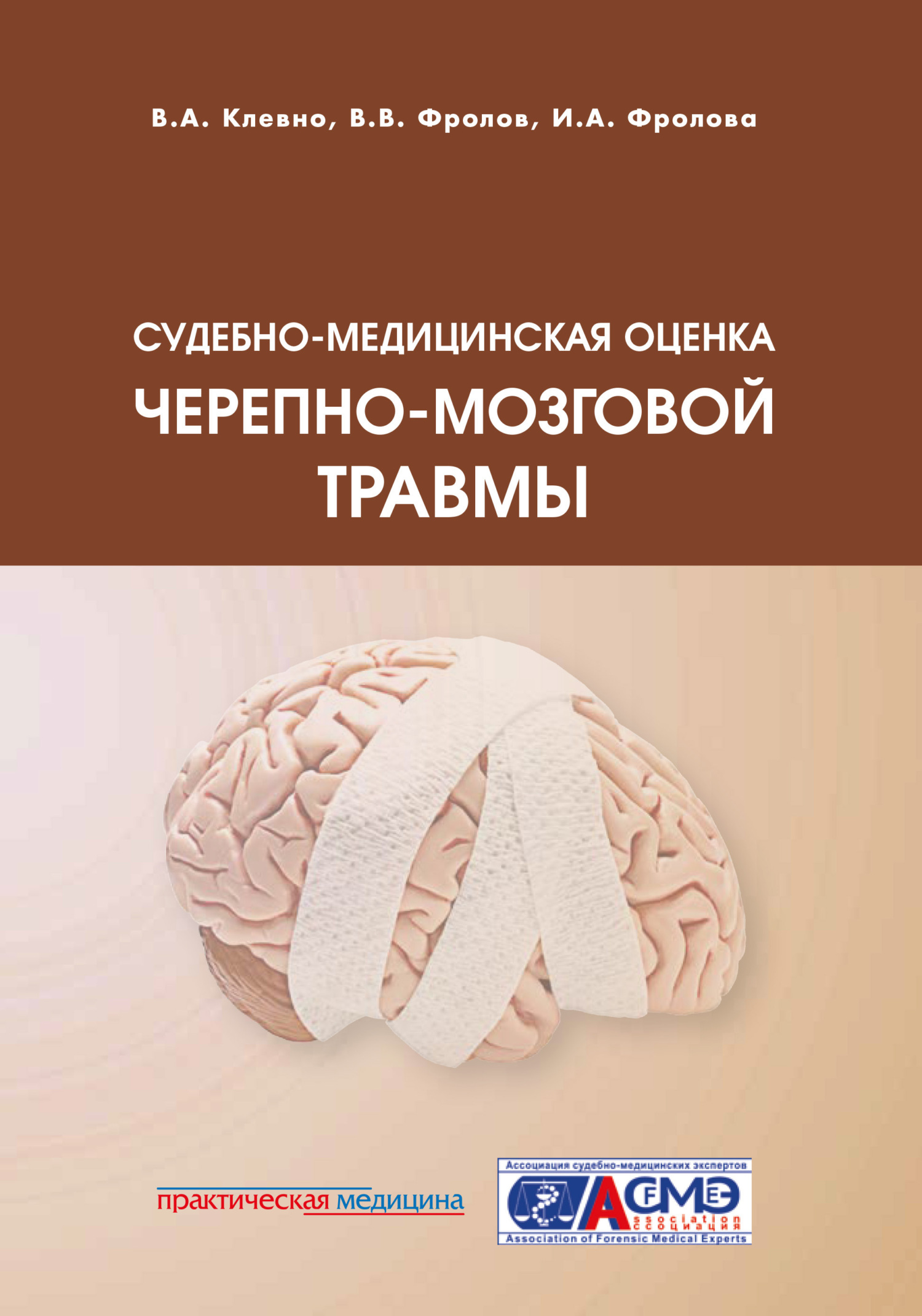 Судебно-медицинская оценка черепно-мозговой травмы, Владимир Александрович  Клевно – скачать pdf на ЛитРес