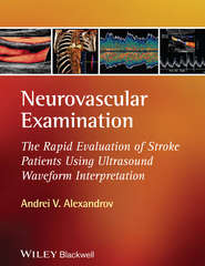 Neurovascular Examination. The Rapid Evaluation of Stroke Patients Using Ultrasound Waveform Interpretation