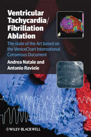 Ventricular Tachycardia \/ Fibrillation Ablation. The state of the Art based on the VeniceChart International Consensus Document