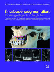 Sinusbodenaugmentation