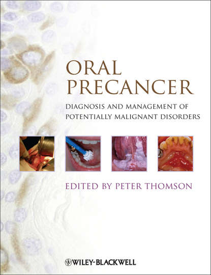 Peter  Thomson - Oral Precancer. Diagnosis and Management of Potentially Malignant Disorders