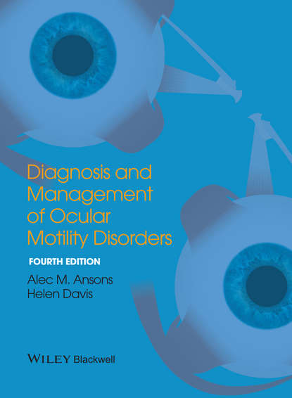 Davis Helen — Diagnosis and Management of Ocular Motility Disorders