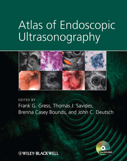 Atlas of Endoscopic Ultrasonography - Группа авторов