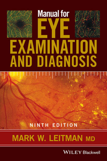 

Manual for Eye Examination and Diagnosis