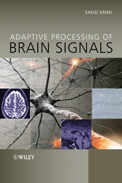 Adaptive Processing of Brain Signals - Saeid Sanei