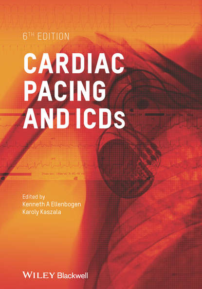 

Cardiac Pacing and ICDs
