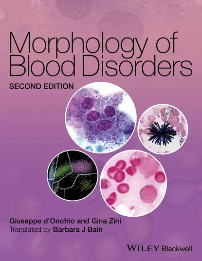 Обложка книги Morphology of Blood Disorders, Giuseppe d'Onofrio