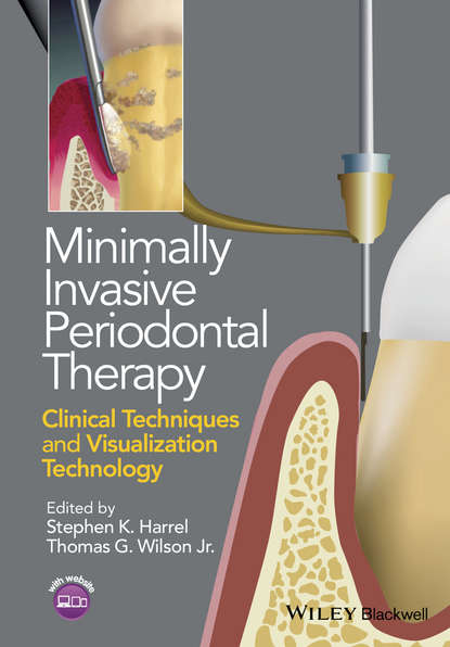 Minimally Invasive Periodontal Therapy