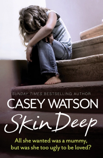 Обложка книги Skin Deep: All She Wanted Was a Mummy, But Was She Too Ugly to Be Loved?, Casey  Watson