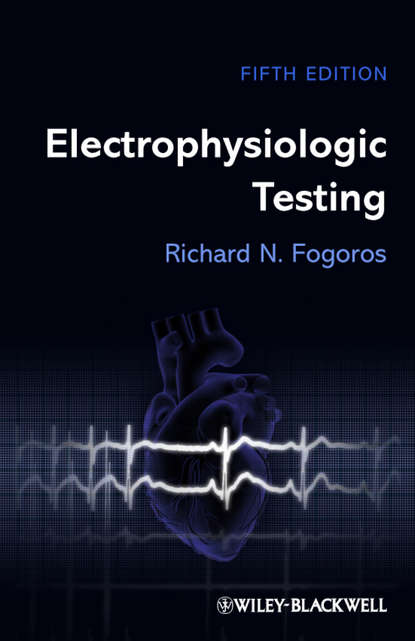 Richard N. Fogoros - Electrophysiologic Testing