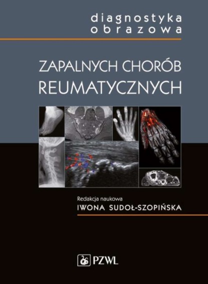 Группа авторов - Diagnostyka obrazowa zapalnych chorób reumatycznych