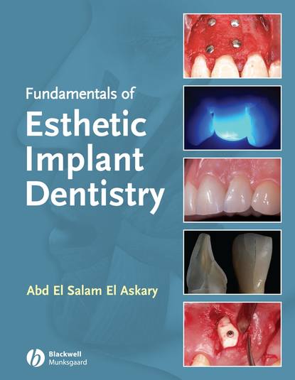 Abdelsalam Elaskary - Fundamentals of Esthetic Implant Dentistry