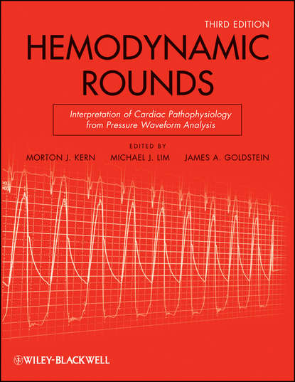 Morton Kern J. - Hemodynamic Rounds