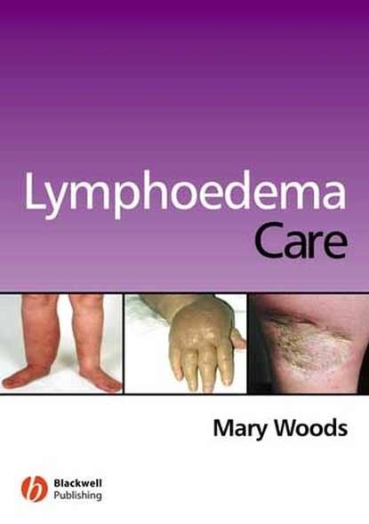 Группа авторов - Lymphoedema Care