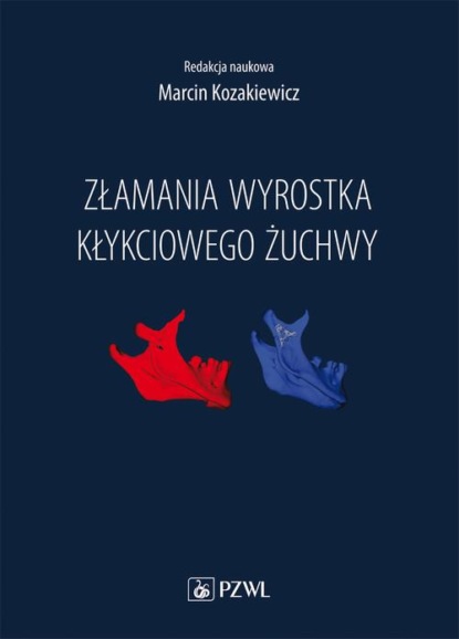 Marcin Kozakiewicz - Złamania wyrostka kłykciowego żuchwy