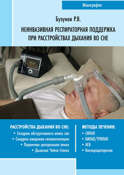 Роман Бузунов — Неинвазивная респираторная поддержка при расстройствах дыхания во сне