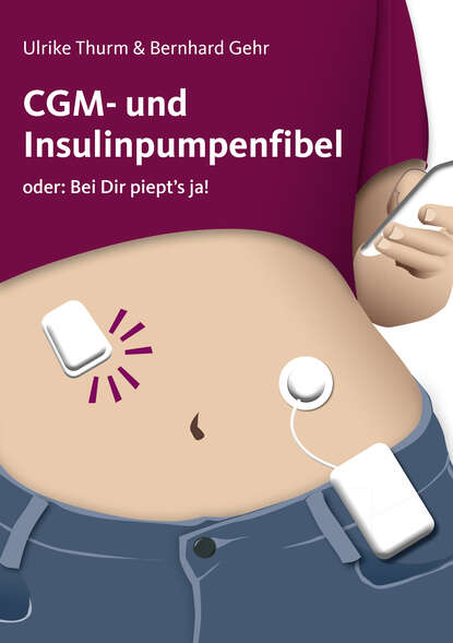 

CGM- und Insulinpumpenfibel