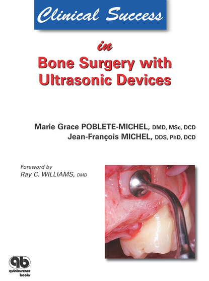 Marie G. Poblete-Michel - Clinical Success in Bone Surgery with Ultrasonic Devices