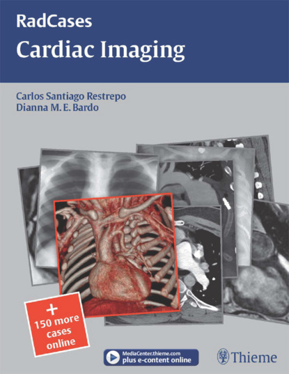 Carlos S Restrepo - Cardiac Imaging