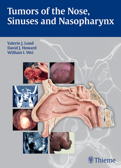 Valerie J. Lund - Tumors of the Nose, Sinuses and Nasopharynx