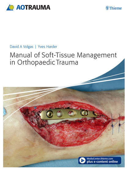 David A. Volgas - Manual of Soft-tissue Management in Orthopaedic Trauma