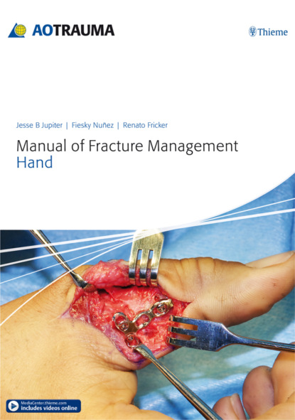 Группа авторов - Manual of Fracture Management - Hand