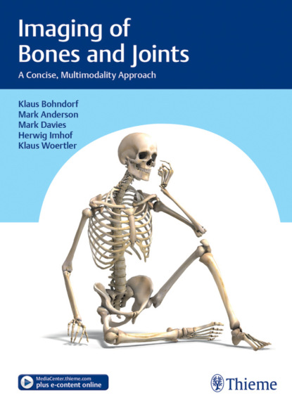 

Imaging of Bones and Joints