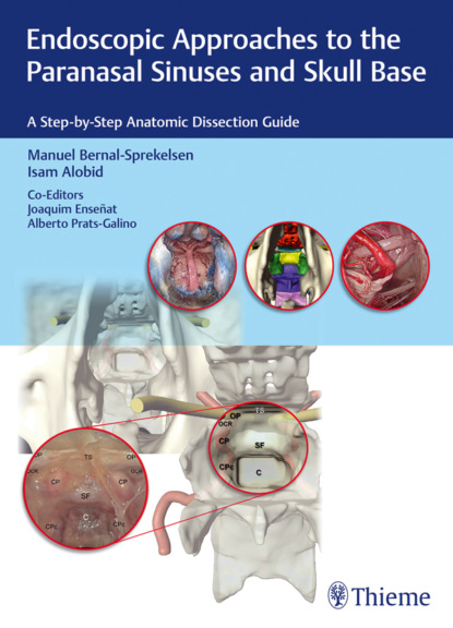 Группа авторов - Endoscopic Approaches to the Paranasal Sinuses and Skull Base