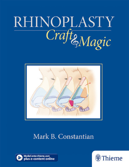 Mark B. Constantian - Rhinoplasty