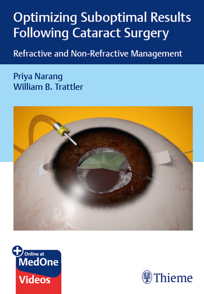 Priya Narang - Optimizing Suboptimal Results Following Cataract Surgery