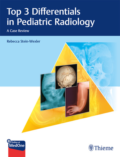 Rebecca Stein-Wexler - Top 3 Differentials in Pediatric Radiology