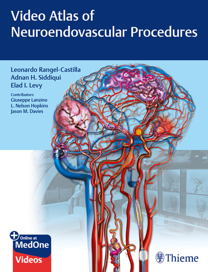 Adnan H. Siddiqui - Video Atlas of Neuroendovascular Procedures