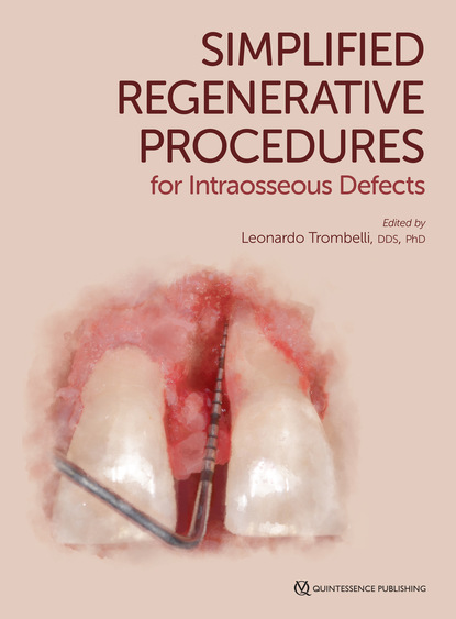 Leonardo Trombelli - Simplified Regenerative Procedures for Intraosseous Defects