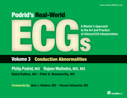 

Podrid's Real-World ECGs: Volume 3, Conduction Abnormalities