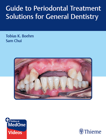 Tobias K. Boehm - Guide to Periodontal Treatment Solutions for General Dentistry