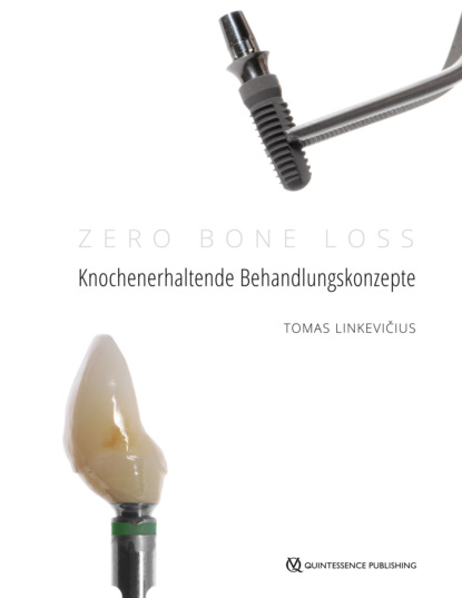 Zero Bone Loss: Knochenerhaltende Behandlungskonzepte (Tomas Linkevičius). 