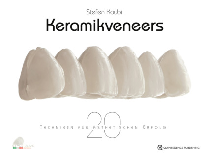 Keramikveneers (Stefen Koubi). 
