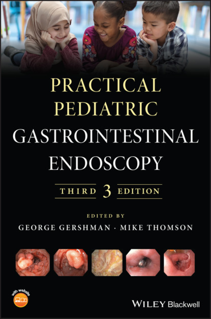 Practical Pediatric Gastrointestinal Endoscopy - Группа авторов