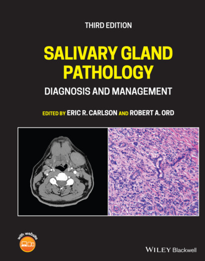 Salivary Gland Pathology (Группа авторов). 