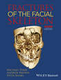 Fractures of the Facial Skeleton