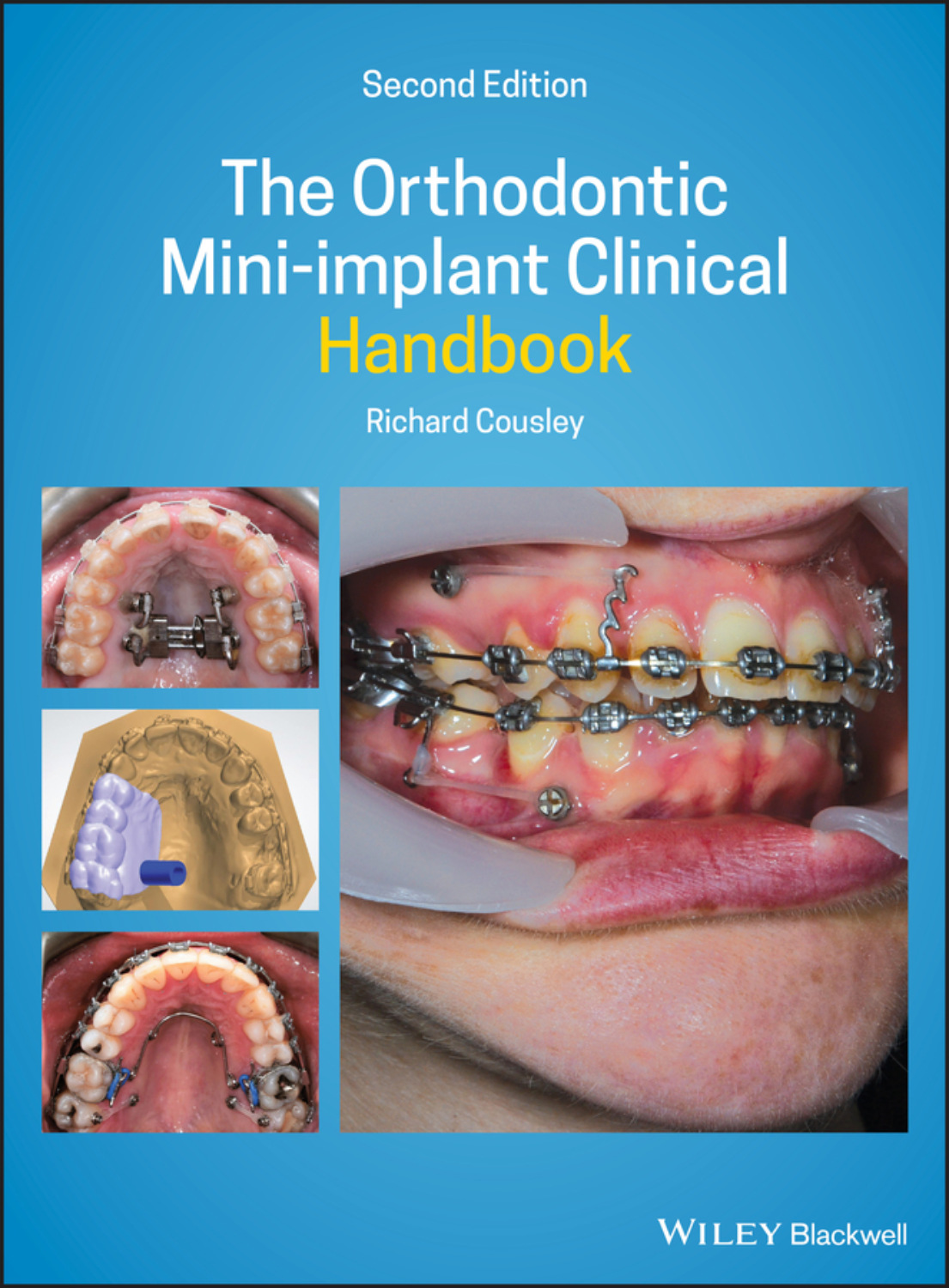 The Orthodontic Mini-implant Clinical Handbook, Richard Cousley – скачать  книгу fb2, epub, pdf на Литрес