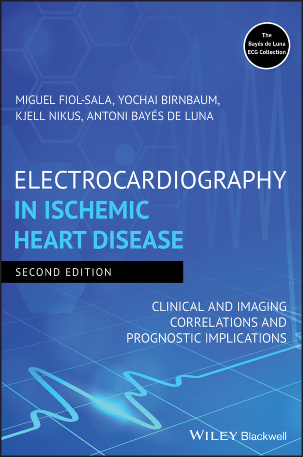 «Electrocardiography In Ischemic Heart Disease», Antoni Bayés De Luna ...